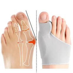 Toe Separator Bunion Corrector